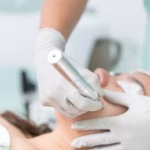 Les critères pour un suivi dermatologique optimal avant une épilation laser à Dijon