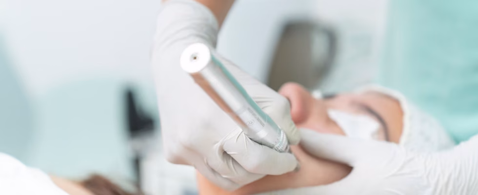 Les critères pour un suivi dermatologique optimal avant une épilation laser à Dijon