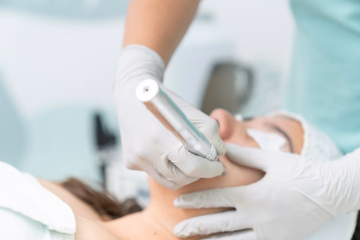 Les critères pour un suivi dermatologique optimal avant une épilation laser à Dijon